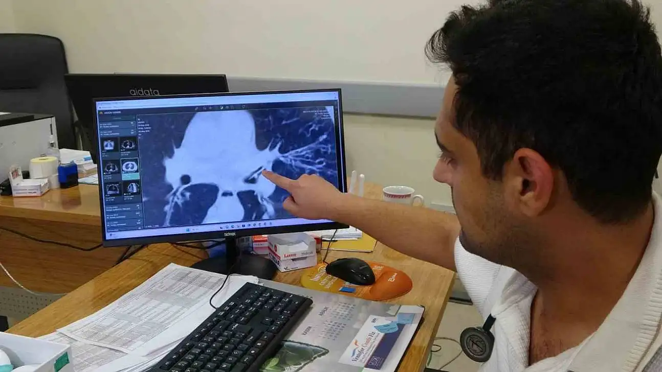 Kansersin, astımsın dediler: Akciğerinden kabak çekirdeği çıktı