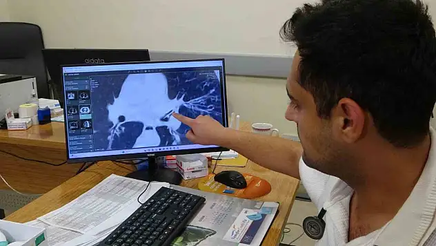 Kansersin, astımsın dediler: Akciğerinden kabak çekirdeği çıktı